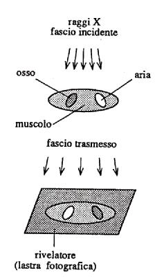 Radiografia Sostituendo allo schermo fluorescente una lastra o pellicola fotografica Immagine negativa le zone più scure risultano le