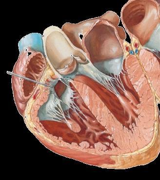 Elements of Cardiac Dyssynchrony Atrioventricular