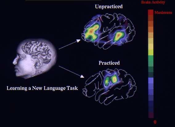 Con la PET e stato possibile vedere le aree cerebrali che si accendono quando siamo impegnati in attivita