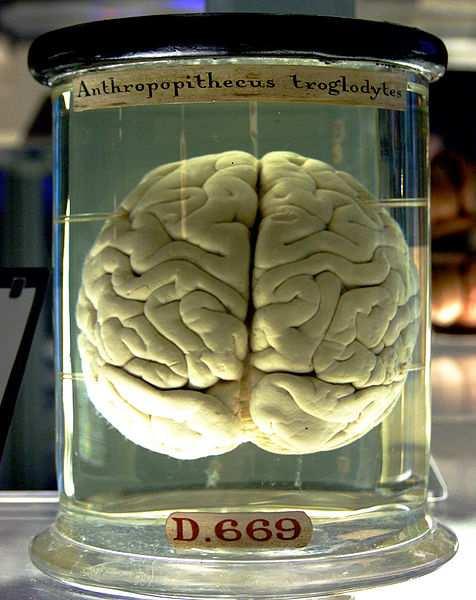 Cervello di Anthropithecus