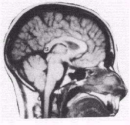 Uomini e donne hanno cervelli simili ma non identici Il cervello maschile,