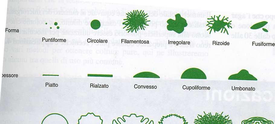 Variazioni rilevabili a occhio nudo nella morfologia delle colonie, forma e andamento generale del suo margine vengono rilevati