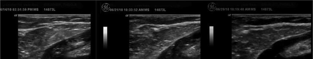 Fisiopatologia Progressione