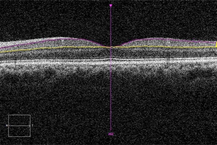 Cellule