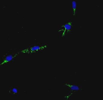 α-actina vimentina S100 cheratina 8-18 CD44v6 HMB45 Fig. 1 Caratterizzazione tramite immunofluorescenza delle cellule TSC isolate dall AML.