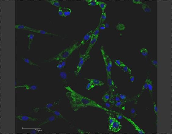 α-actina Vimentina Cheratina 8/18 S100 HMB45 CD44v6 Fig.