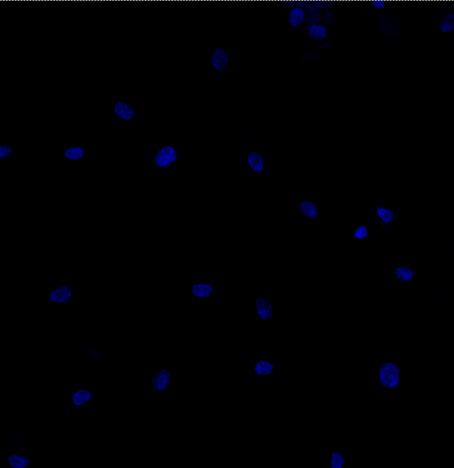 cellule lipidiche e cheratina 8-18, marcatore di cellule