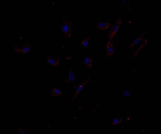 VSCM TSC2 -/meth TSC2 -/- cellule LAM/TSC isolate dal chilo tuberina fosfo-tuberina amartina amartina tuberina Fig.