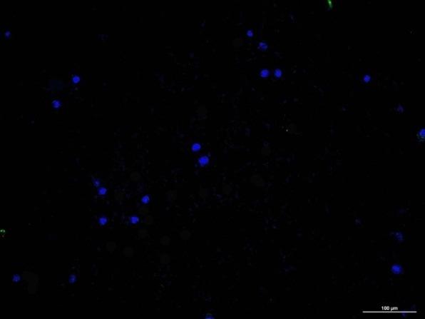 Valutazione del ciclo di adesione delle cellule LAM/TSC floating isolate dal chilo.