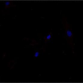 TSC2 -/meth Cellule TSC2 -/meth +5-AZA 50 µm 50 µm d) 90 % di cellule 80 70 60 50 40 30 TSC2-/meth ASM cell TSC2-/meth ASM cell + TSA 20 10 0 + - Fig.