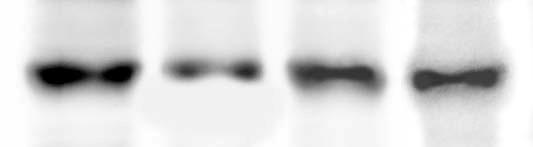 Cellule Cellule Cellule Cellule TSC2 -/meth TSC2 -/meth TSC2 -/- TSC2 -/- +TSA +TSA P-S6 S6 P-Erk Erk Fig.