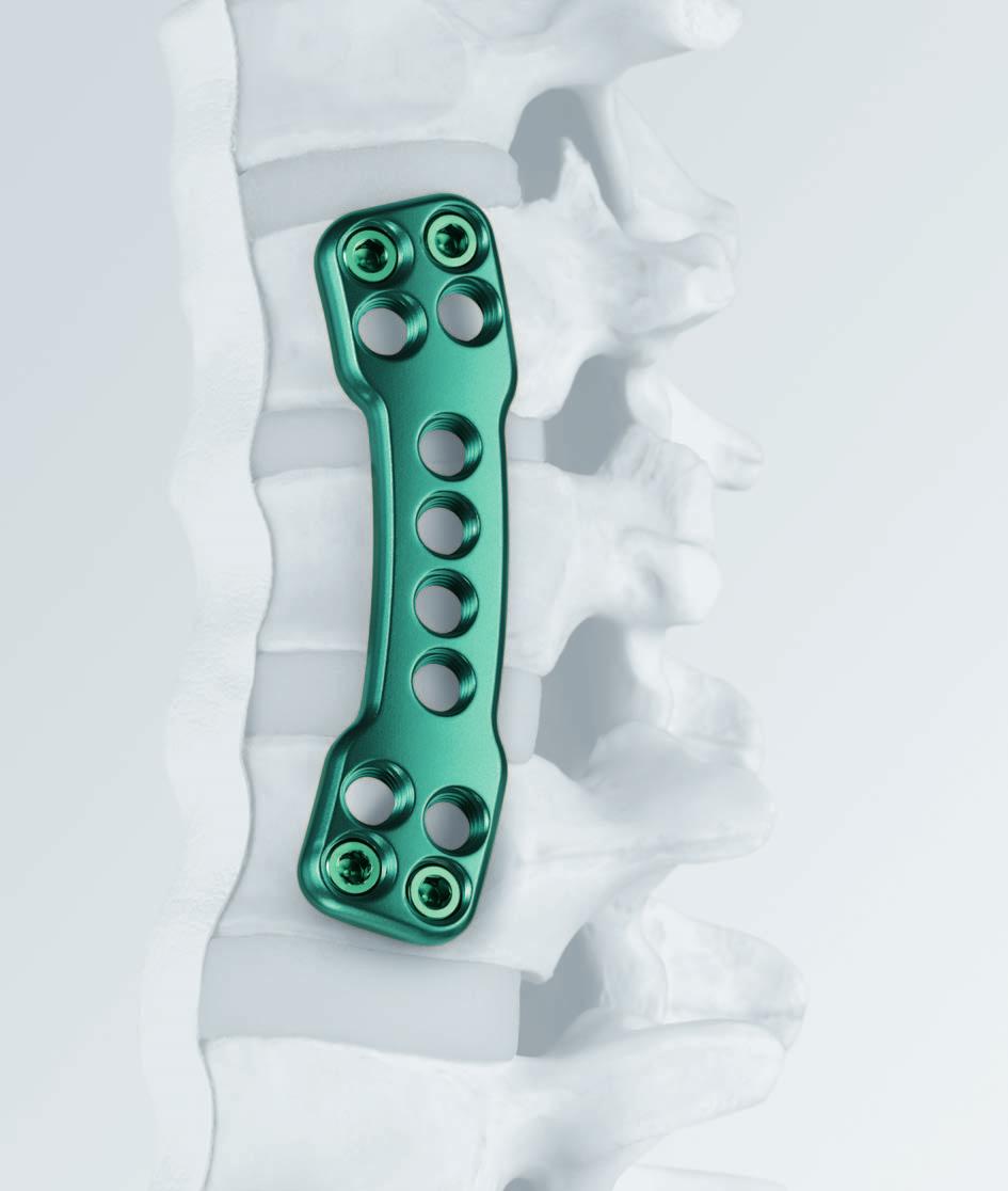 Tecnica chirurgica TSLP Thoracolumbar Spine Locking Plate.