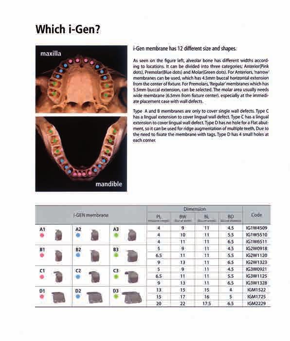 Perchè I-Gen? La membrana i-gen ha 12 dodici misure e forme diverse. Come dimostra la figura a sinistra, l osso alveolare ha ampiezze diverse a seconda delle posizioni.