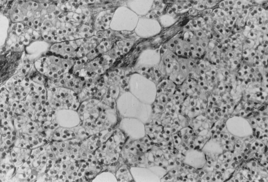 Cellule principali, con citoplasma