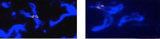 FISH) nuclei interfasici (FISH in interfase) fibre di