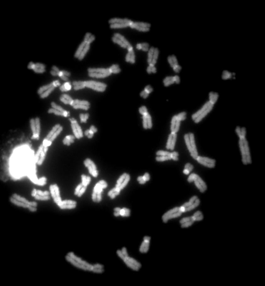 La ALU-PCR utilizza primer disegnati sulle sequenze Alu ma con orientamento