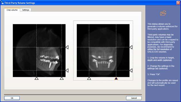 3 Esportazione dati DICOM Sirona Dental Systems GmbH Esportazione di volumi per software di terzi Istruzioni d'uso DICOM Removable Media Plug-in Versione 3.3 3.