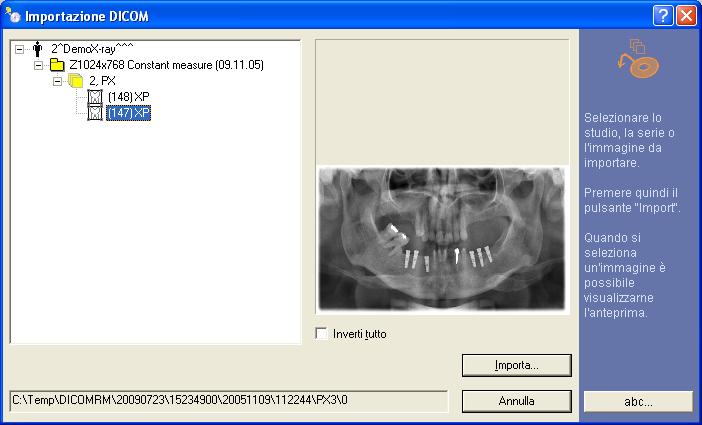 Conformemente ai dati importati viene creato un nuovo paziente con un nuovo esame che comprende tutte le immagini importate. 4.