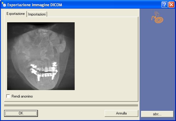 Sirona Dental Systems GmbH Istruzioni d'uso DICOM Removable Media Plug-in Versione 3.3 3 Esportazione dati DICOM Esportazione di immagini Scheda di registro Esportazione 1.
