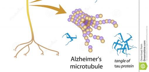 https://thumbs.dreamstime.com/z/disintegrating microtubules alzheimer disease 27017468.