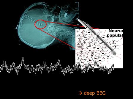 RESEARCH AREA 1: NEUROPHYSIOLOGY AND