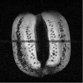 Siliforce e kiwi Si ottengono 3 immagini di sezioni ortogonali (assiale, sagittale e coronale) in cui l intensità del segnale è proporzionale al solo contenuto d acqua nel tessuto.