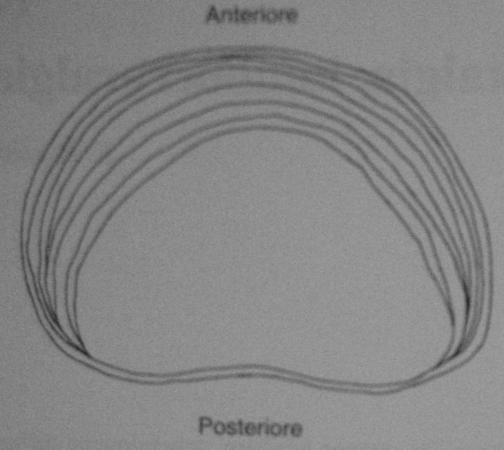 Il disco intervertebrale