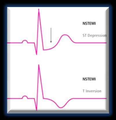 clopidogrel (doppia