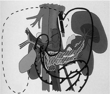 arco dell aorta trachea c v