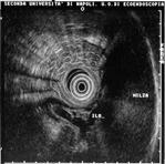 aorta pil dx pil sx aorta