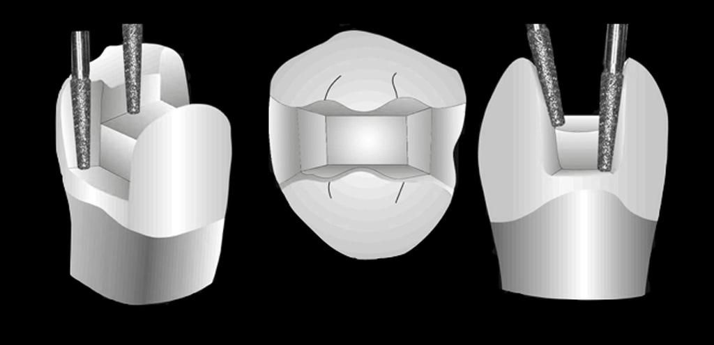 CONCETTI E TECNICHE DI ODONTOIATRIA CONSERVATIVA ADESIVA ESTETICA Scopo di questo Corso è di sottolineare concetti e passaggi clinico-operativi delle più moderne tecniche, facendo inoltre il punto