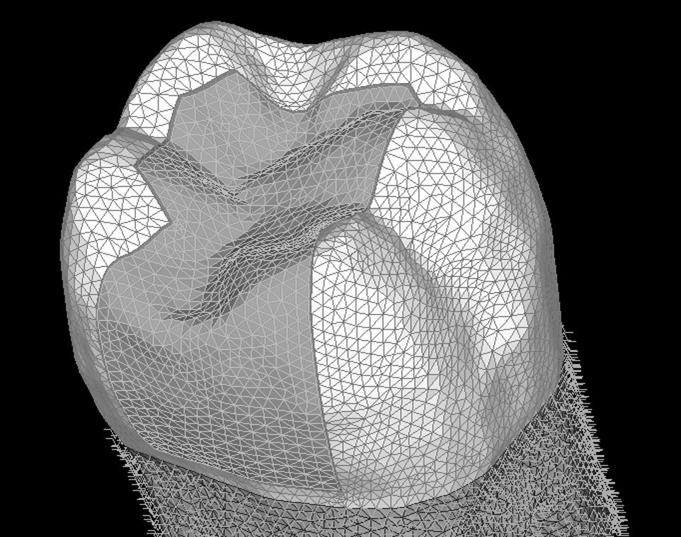 IL CORSO ODONTOIATRIA CONSERVATIVA ADESIVA ESTETICA ECM: OBIETTIVO FORMATIVO DI SISTEMA LINEE GUIDA - PROTOCOLLI - PROCEDURE 36 ECM PRESENTAZIONE DEL CORSO 20 posti 36 ECM 13-14 aprile 2018 25-26