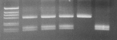 Diagnosi prenatale CF Xv-2c: extragenico, ~200 kb 1-2 1-2 1-2 1-1 allele 1 p?