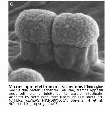 E.coli STEC* O104:H4 responsabile focolaio tedesco nel 2011 - USA: 73.000 casi d'infezione ; circa 600 morti /anno.