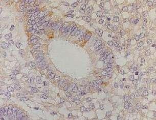 Endometrial cell Cell proliferation and differentiation