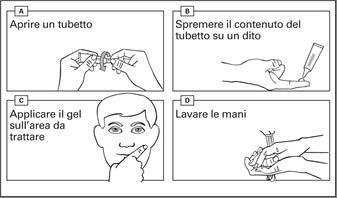 - L effetto completo di Picato può essere valutato dopo circa 8 settimane dal trattamento.