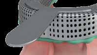 Tecnica con portaimpronte chiuso FASE 1 Rimuovere le viti di chiusura.