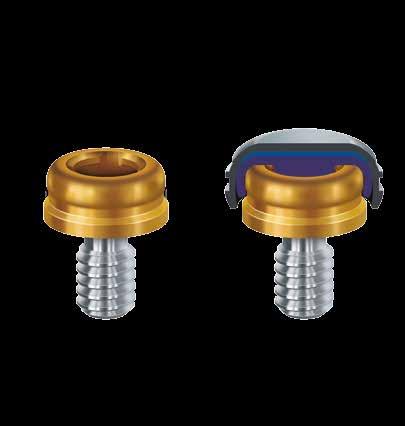 La soluzione ottimale di ancoraggio per overdenture B C D POSIZIONAMENTO FACILITATO Protesi ben posizionabile grazie alla conformazione della testa del moncone.