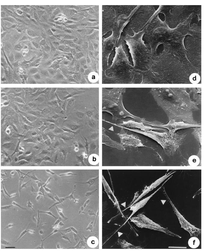 Introduzione Fig. 4: Effetti di TDH su cellule IEC-6.