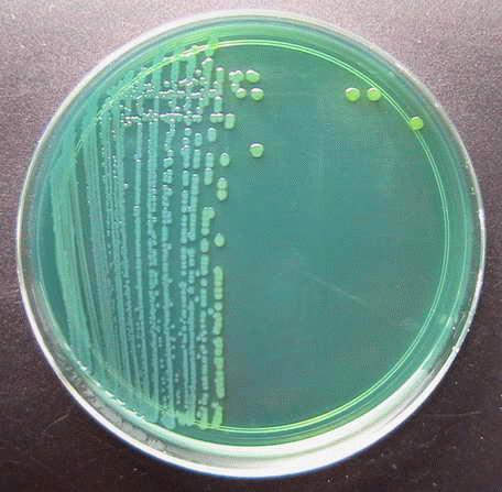 Materiali e metodi colonie viola, dopo incubazione a 35-37 C per 20 ore; gli altri Vibrio non danno sviluppo di colonie o