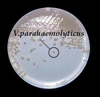 Vibrio mimicus e Vibrio vulnificus, che su terreno TCBS sono difficilmente distinguibili da Vibrio parahaemolyticus, danno