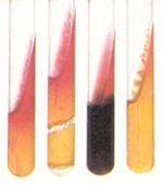 Materiali e metodi Salvo eccezioni, Vibrio spp. da reazione alcalina (rossa) nel becco di clarino ed acida (gialla) nel cilindro, senza produzione di gas e di idrogeno solforato. Nessun Vibrio spp.