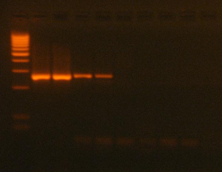 Risultati Le figure 11 e 12 mostrano, a titolo esemplificativo, le immagini delle corse elettroforetiche relative alla prova 2.