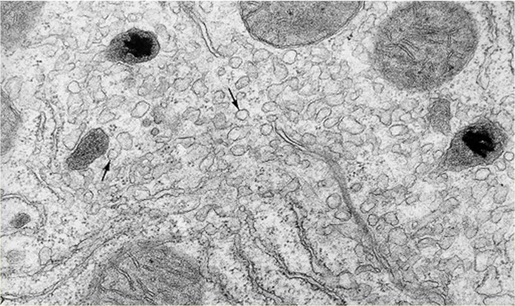 Reticolo endoplasmatico liscio assume caratteristiche di specializzazione in alcune cellule (fibre
