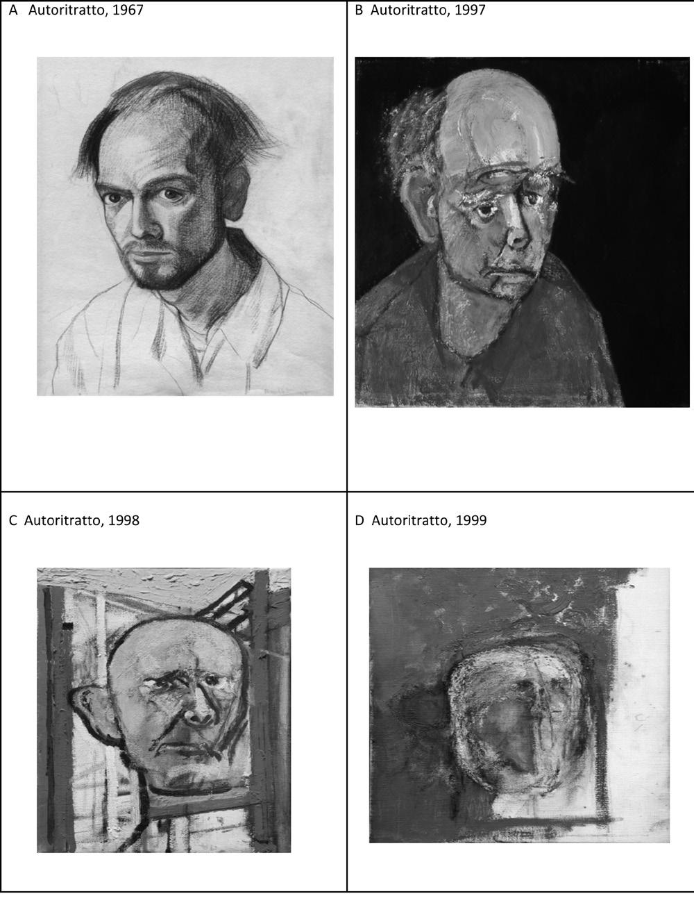 Demenza e arte pittorica 31 Figura 3: William Utermohlen, Autoritratto. Rappresentazioni del medesimo soggetto prima (A) e durante ( B- C- D) l insorgenza della malattia.
