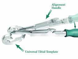 Canale Gruppo 7A Piatto tibiale di prova universale Manico di allineamento Gruppo 7B > Mantenere premuta la leva nella posizione anteriore del manico di allineamento.