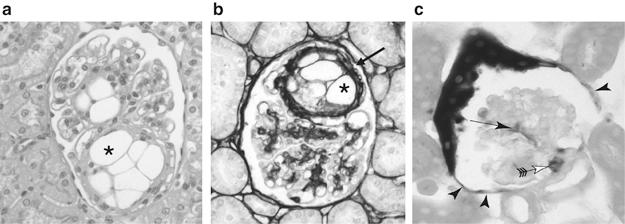 Kunter U, Rong S, Moeller MJ et al.