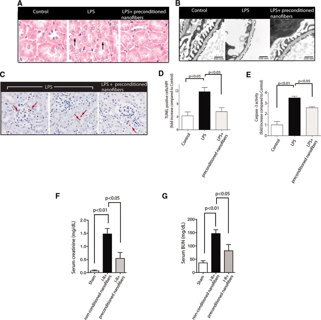 Preconditioned nanofibers are renoprotective in experimental models of AKI.