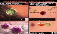 Senza più questo ormone in circolo lo zucchero non può essere bruciato dalle cellule dell'organismo, causando l'iperglicemia.