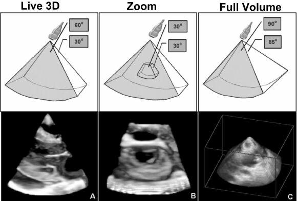 ETT 3D CENNI TECNICI E TECNICHE D ACQUISIZIONE 3 PRINCIPALI MODALITA D ACQUISIZIONE: LIVE 3D (X-plane): possibilità di vedere in tempo reale l immagine in 2 piani ortogonali,ideale per valutare